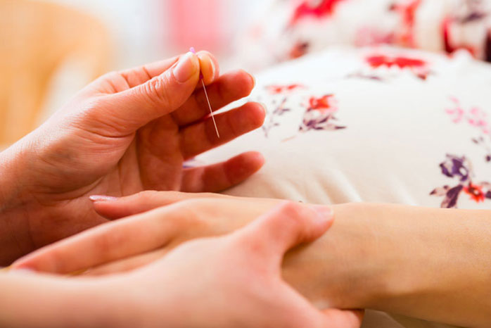 Acupuncture for Fertility